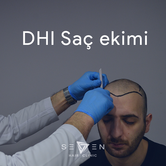 DHI saç ekiminde nelere dikkat edilmelidir.