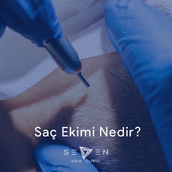 Saç Ekimi nedir?